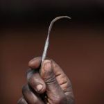 FEMALE GENITAL MUTILATION (FGM)